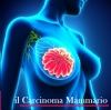 Formazione sul carcinoma mammario