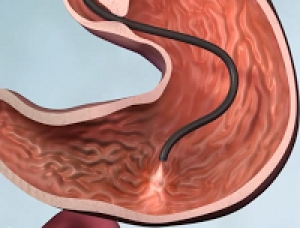 Formazione: Urgendo corso sulla gestione delle emorragie digestive