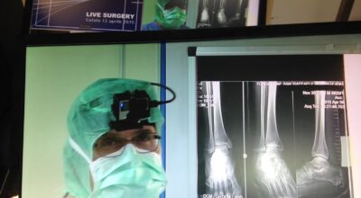 Sanità, livesurgery da ospedale Cefalù per 500 ortopedici