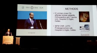Ortopedia, premiata ricerca su osteoartrosi