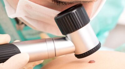 Ripresa attività ambulatorio di dermatologia