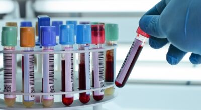 Coronavirus: centro prelievi resta chiuso il sabato