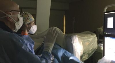 Radiologia interventistica, primo intervento di embolizzazione della milza