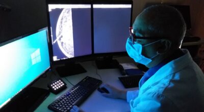 Breast unit: cup dedicato per follow up