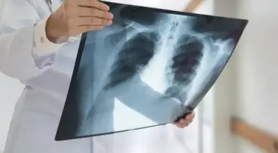 Avviso di lavoro tramite selezione pubblica per l’assegnazione di n. 1 contratto di collaborazione Libero Professionale con P.IVA quale Medico specialista in RADIODIAGNOSTICA