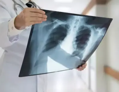 Avviso di lavoro tramite selezione pubblica per l’assegnazione di n. 1 contratto di collaborazione Libero Professionale con P.IVA quale Medico specialista in RADIODIAGNOSTICA