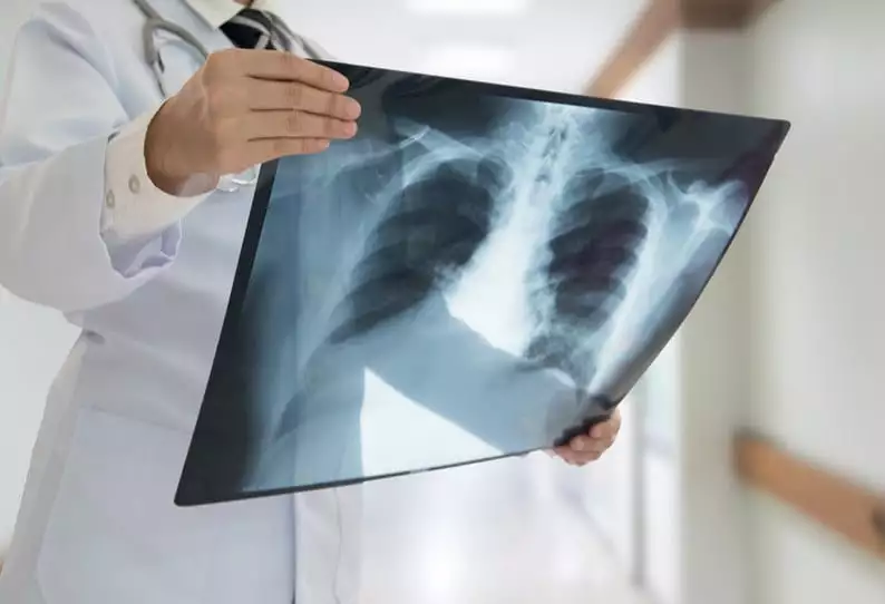 Avviso di lavoro tramite selezione pubblica per l’assegnazione di n. 1 contratto di collaborazione Libero Professionale con P.IVA quale Medico specialista in RADIODIAGNOSTICA