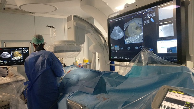 Avviso di lavoro tramite selezione pubblica per l’assegnazione di n. 1 contratto a tempo determinato quale MEDICO SPECIALISTA IN RADIODIAGNOSTICA con expertise in RADIOLOGIA INTERVENTISTICA