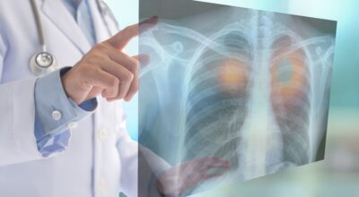 Avviso di lavoro tramite selezione pubblica per l’assegnazione di n. 1 contratto a tempo indeterminato quale MEDICO SPECIALISTA IN ONCOLOGIA
