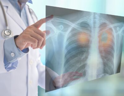 Avviso di lavoro tramite selezione pubblica per l’assegnazione di n. 1 contratto a tempo indeterminato quale MEDICO SPECIALISTA IN ONCOLOGIA