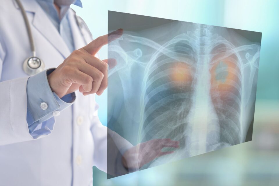 Avviso di lavoro tramite selezione pubblica per l’assegnazione di n. 1 contratto a tempo indeterminato quale MEDICO SPECIALISTA IN ONCOLOGIA